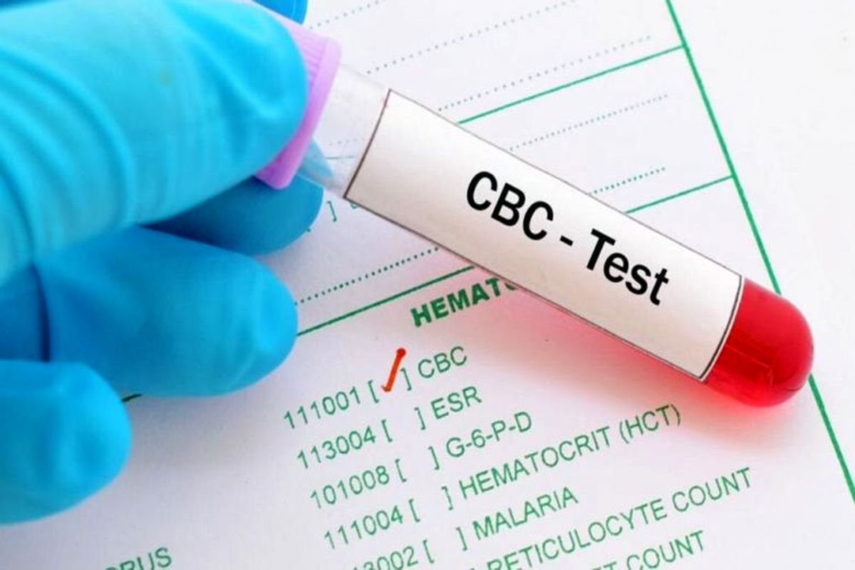 آزمایش CBC چیست؟